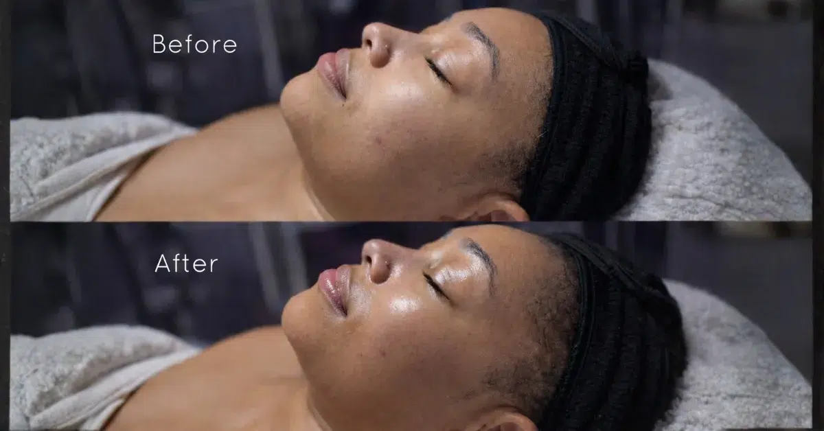 Skin analysis for aging skin at Viviane Aires Skin Wellness