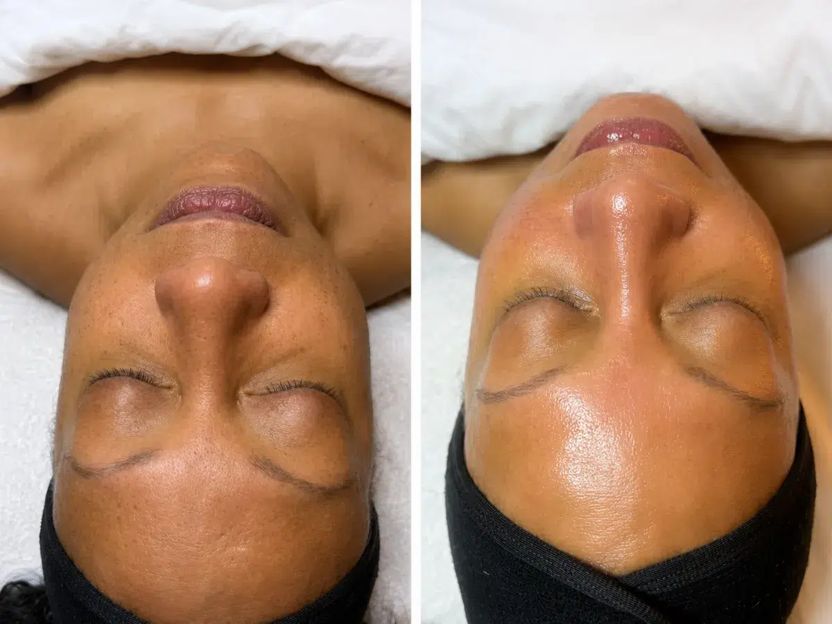 Women 40+ anti aging facial treatment