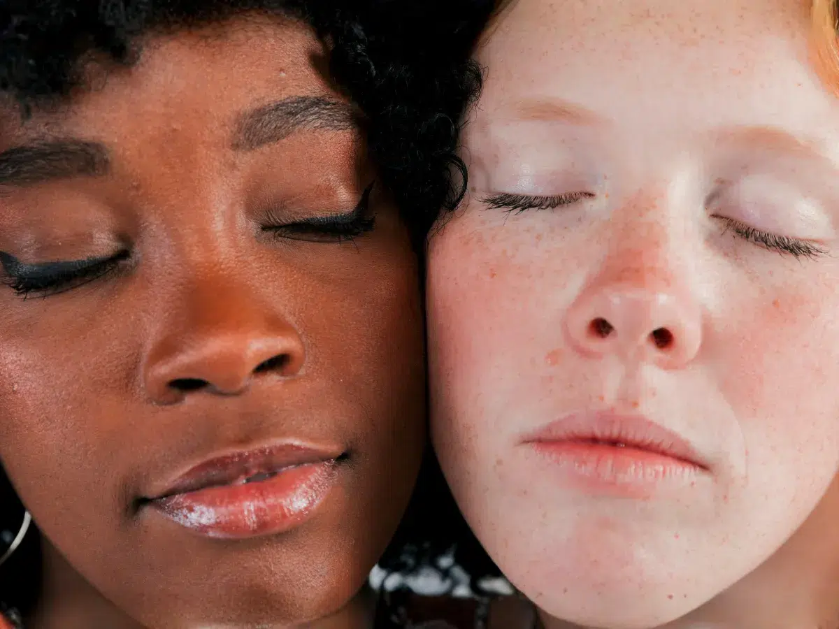 Dull dry skin on the face with dehydration and rough texture