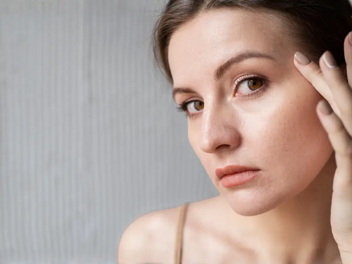 Sensitive skin with a damaged skin barrier and visible dryness